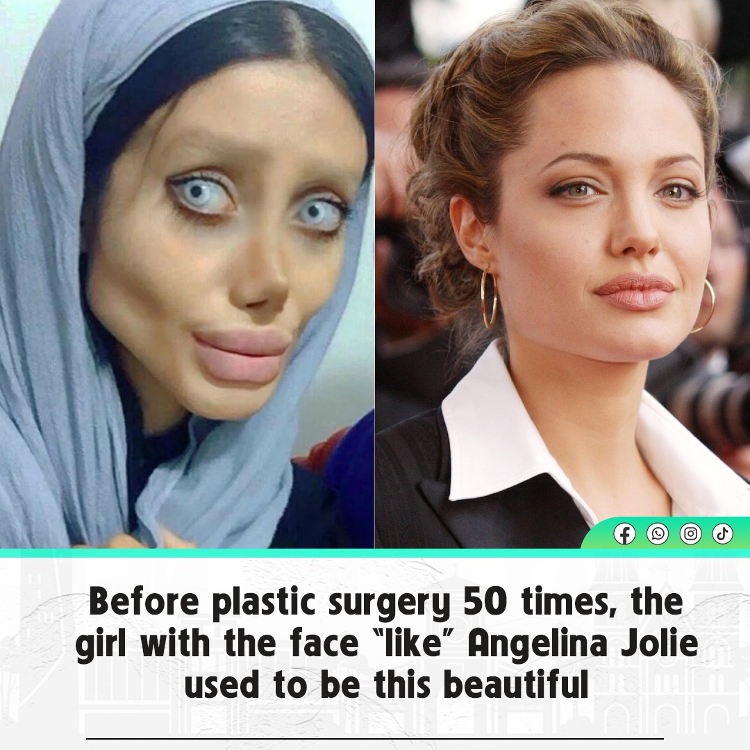 Before 50 plastic surgeries, the girl with the face 