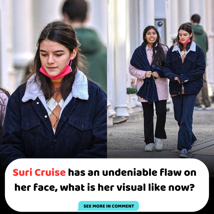 Suri Cruise has an undeniable flaw on her face, what is her visual like ...