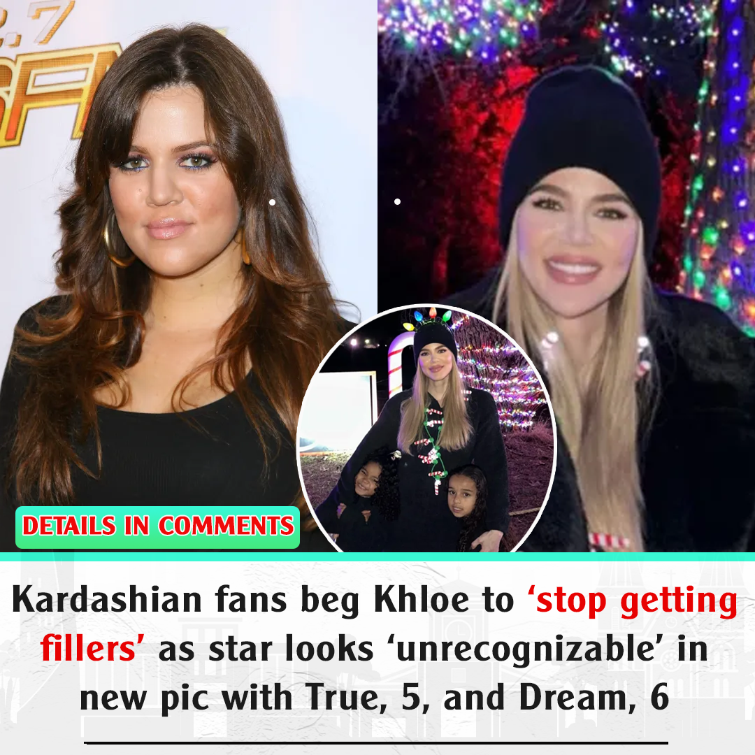 Kardashian Fans Beg Khloe To ‘stop Getting Fillers As Star Looks ‘unrecognizable In New Pic 3163